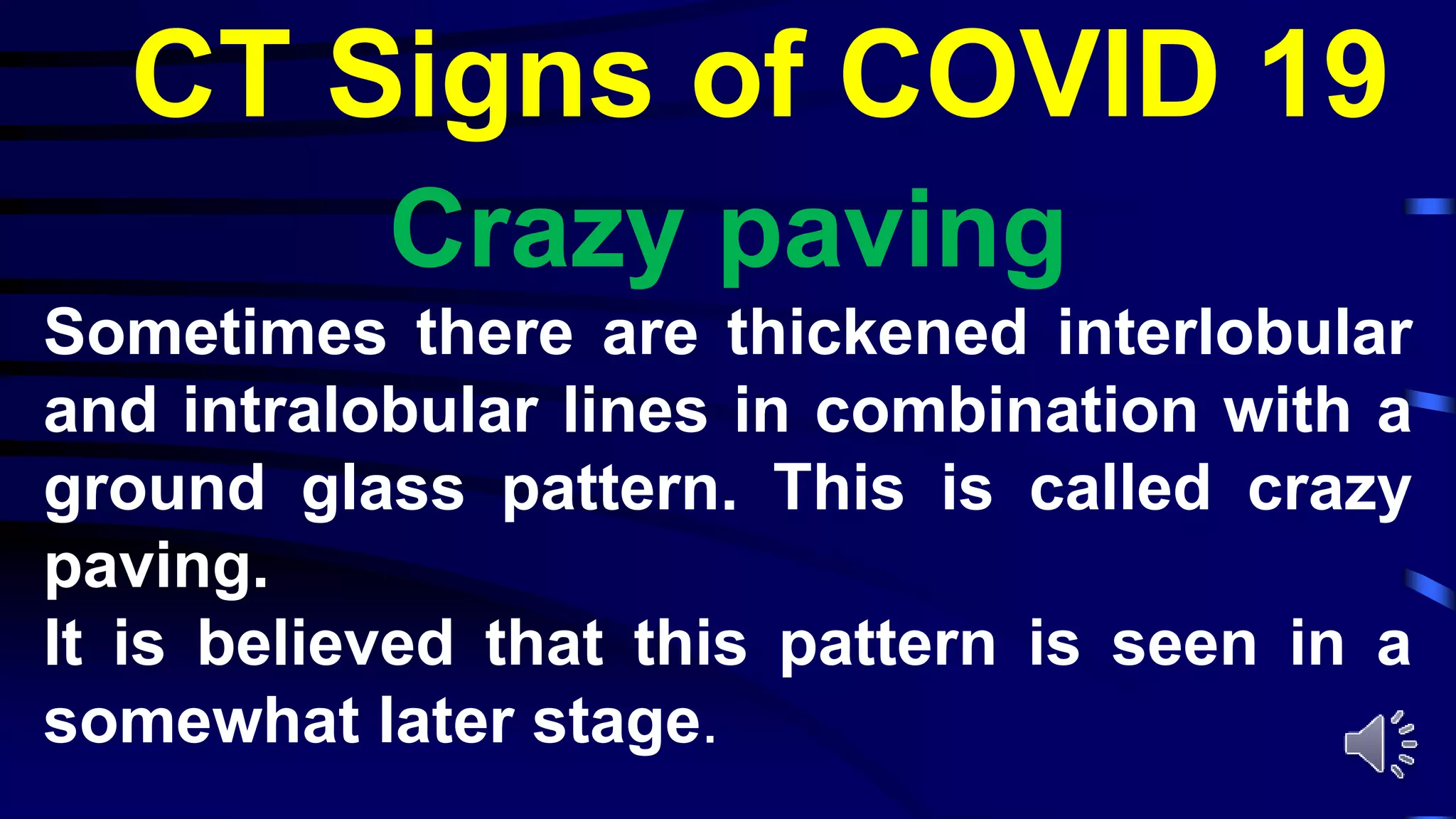Crazy paving
Sometimes there are thickened interlobular
and intralobular lines in combination with a
ground glass pattern. This is called crazy
paving.
It is believed that this pattern is seen in a
somewhat later stage.
CT Signs of COVID 19
 
