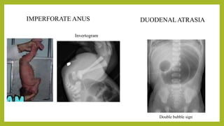 Comprehensive Radiological Imaging of the Gastrointestinal Tract ...