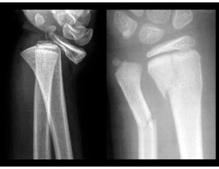 Sharp Force Trauma Radiograph Radiological Imaging of Musculoskeletal Trauma.pdf