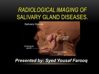 RADIOLOGICAL IMAGING OF
SALIVARY GLAND DISEASES.
Presented by: Syed Yousaf Farooq
 