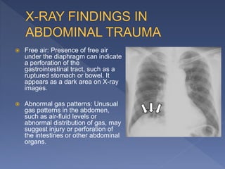 RADIOLOGICAL INVESTIONS IN A TRAUMA VICTIM_113032.pptx