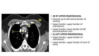 Radiological mapping of mediastinum.pptx