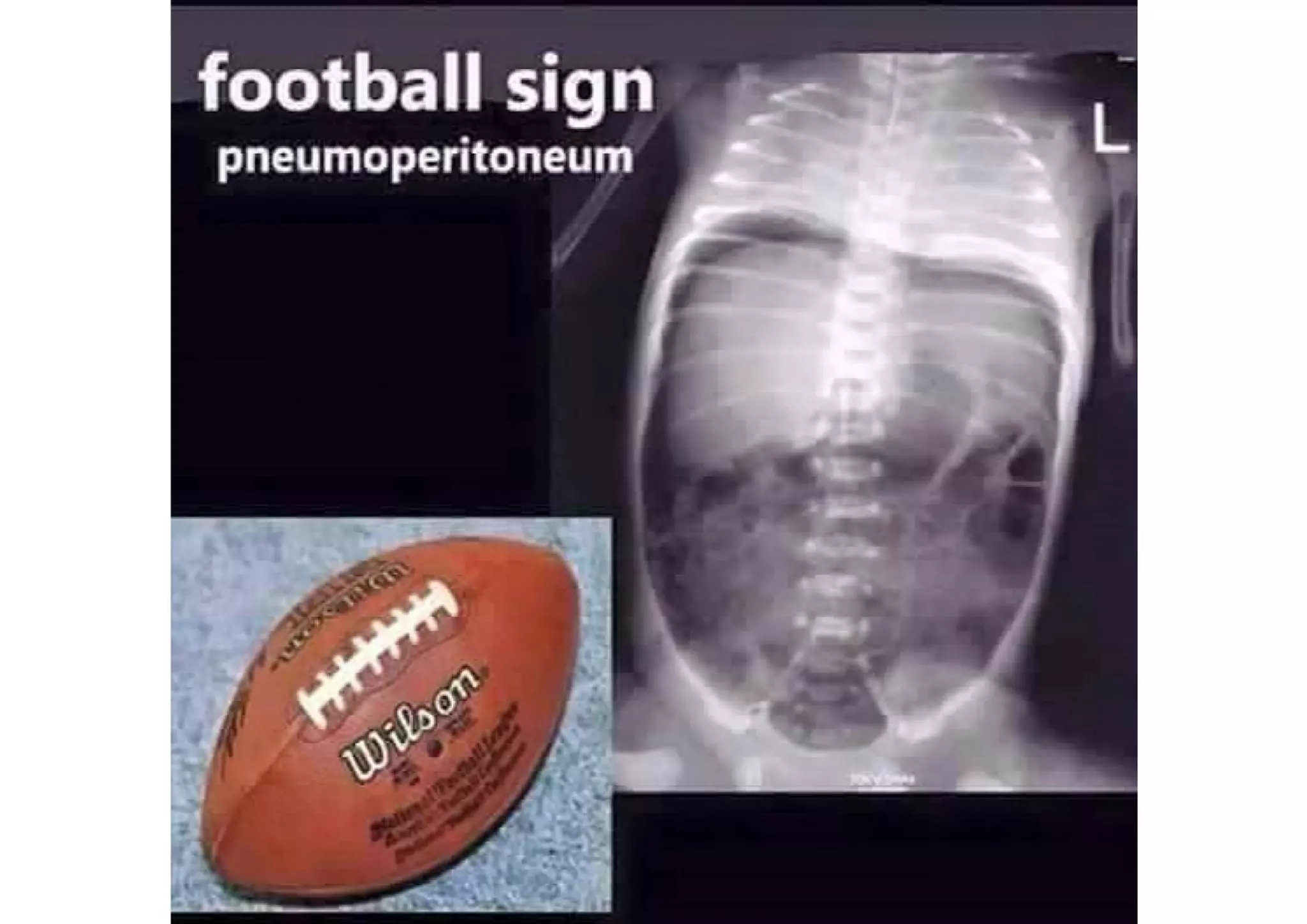 Radiological signs | PDF