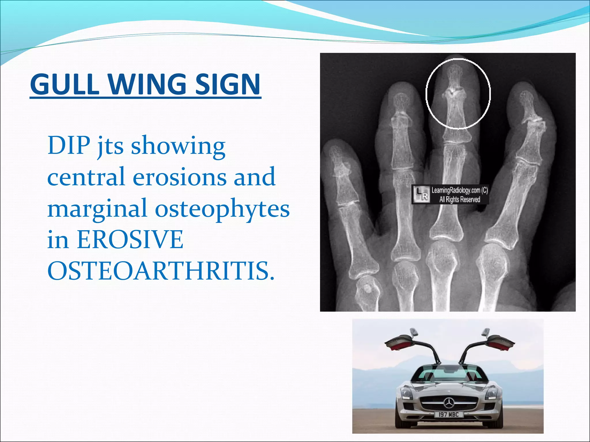 Radiology signs | PPT
