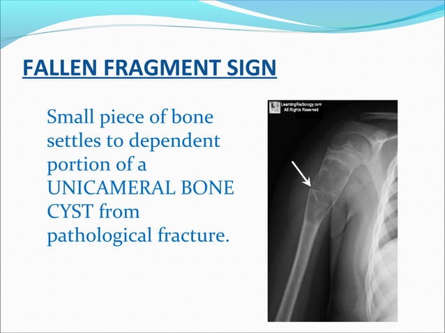 Radiology signs | PPT