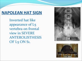 Radiology signs | PPT
