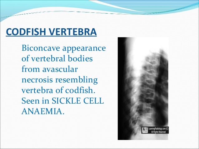 Radiology signs