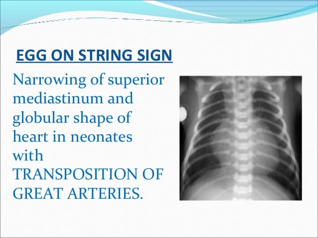 Radiology Signs