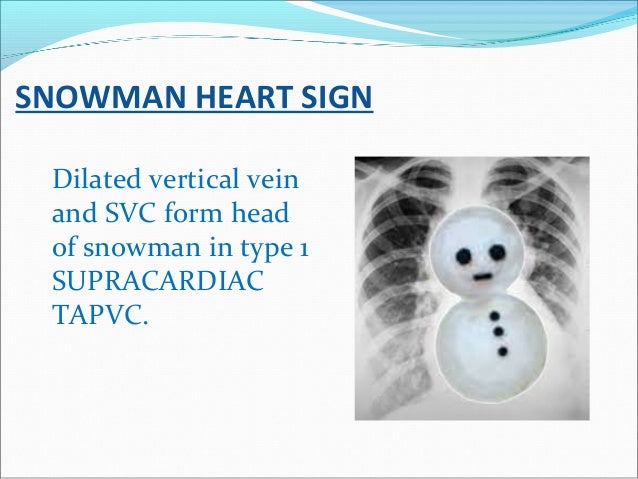 Radiology signs
