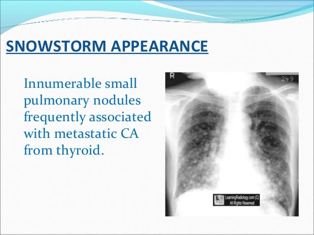 Radiology signs