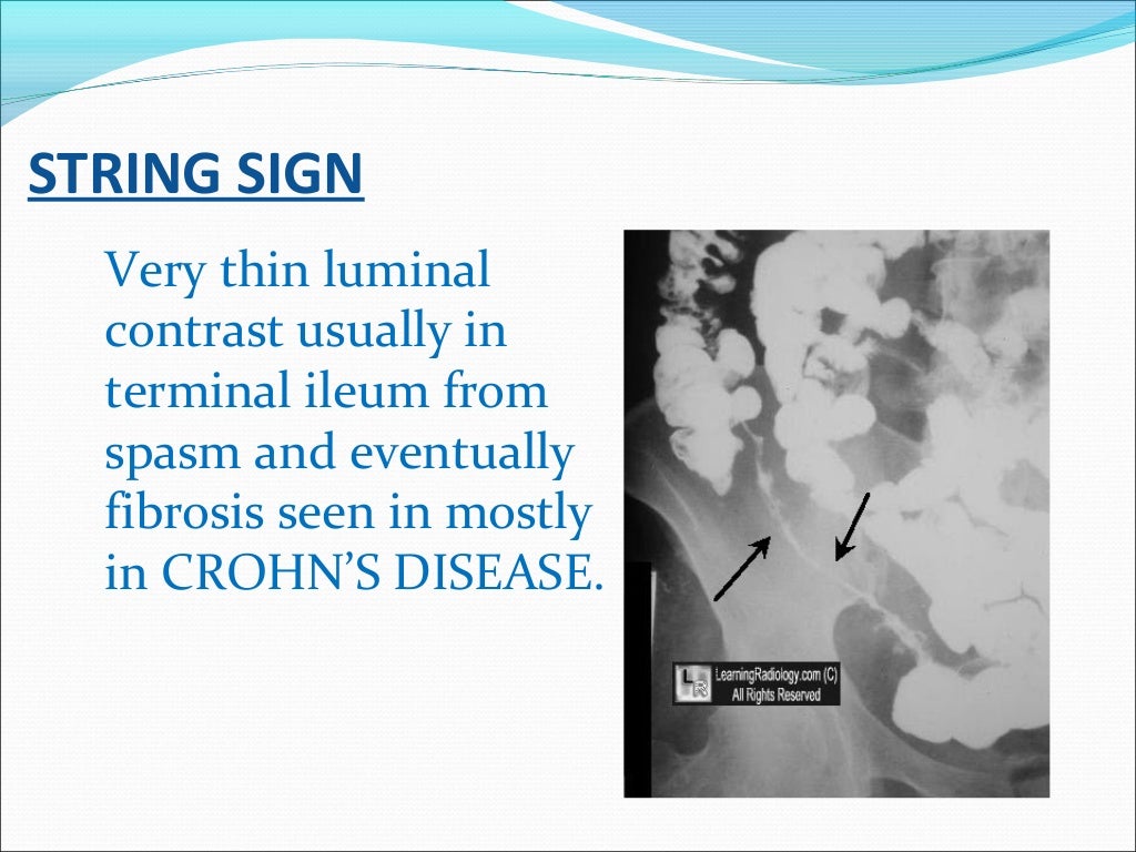 Radiology signs