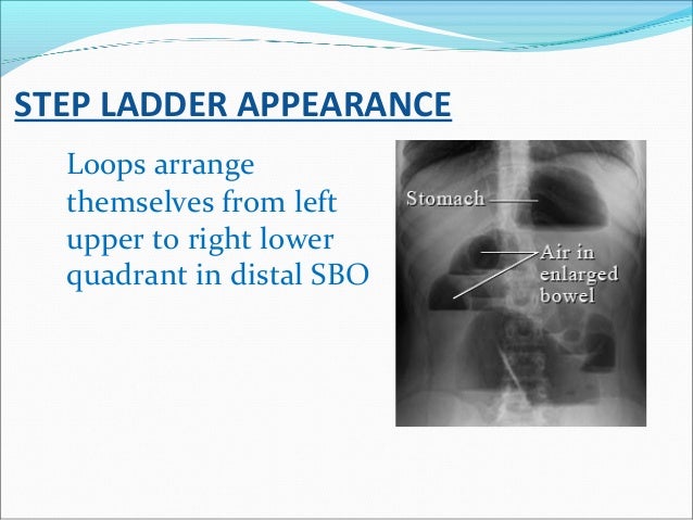 Radiology signs