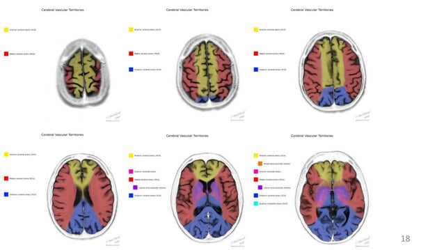 Radiologic Anatomy of the Blood Supply to the Brain.pptx | Brain and ...