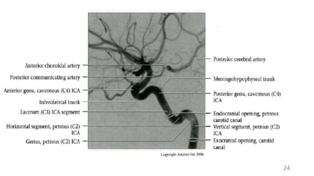 Radiologic Anatomy of the Blood Supply to the Brain.pptx | Brain and ...