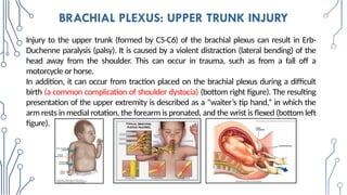 Radiologic_Anatomy_of_the_Brachial_plexus [final].pptx