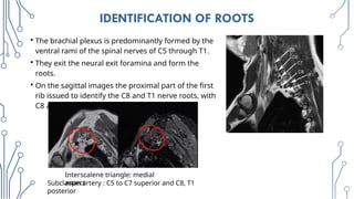 Radiologic_Anatomy_of_the_Brachial_plexus [final].pptx