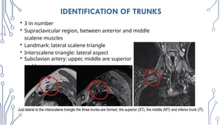 Radiologic_Anatomy_of_the_Brachial_plexus [final].pptx