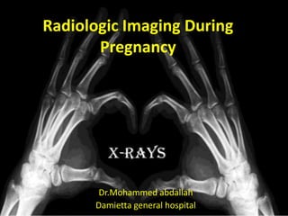 Radiologic Imaging During
Pregnancy
Dr.Mohammed abdallah
Damietta general hospital
 