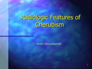 Radiologic Features of Cherubism  Amin Abusallamah 