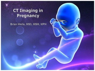 CT Imaging in Pregnancy Brian Wells, MS3, MSM, MPH 1 