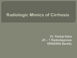 Dr. Pankaj Kaira
JR – 1 Radiodiagnosis
SRMSIMS Bareilly
 