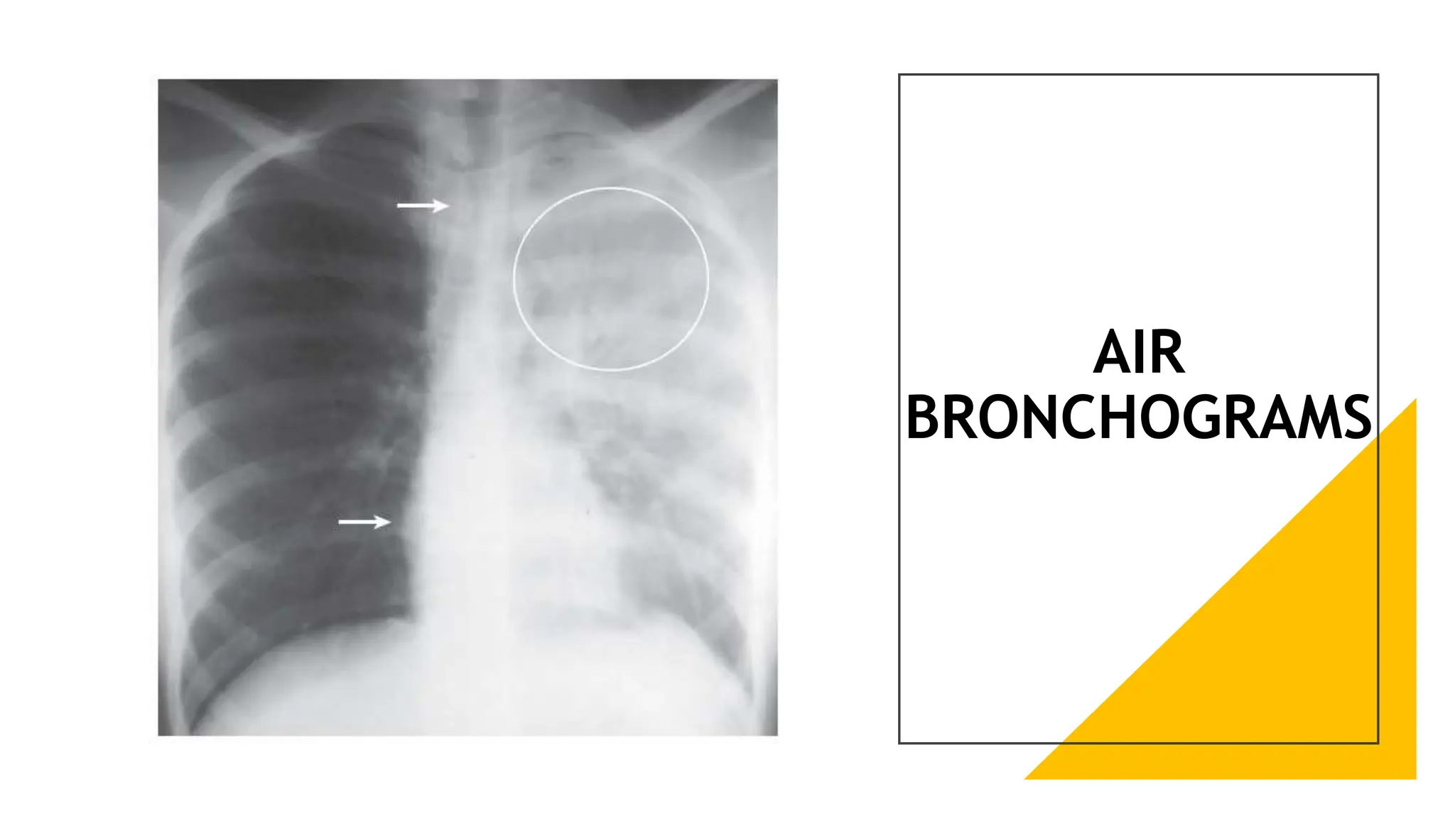 RADIOLOGIC PULMONARY ANATOMY STUDIES.PPT