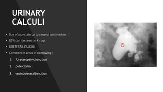 RADIOLOGIC PULMONARY ANATOMY STUDIES.PPT