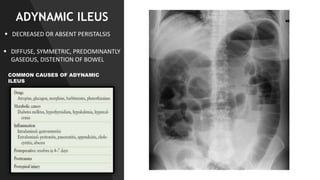 RADIOLOGIC PULMONARY ANATOMY STUDIES.PPT