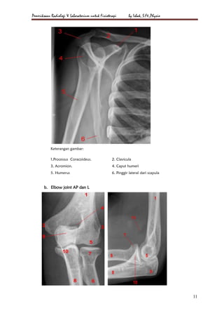 Loopografi Normal Radiologi Radiologi & laboratorium a4 | PDF