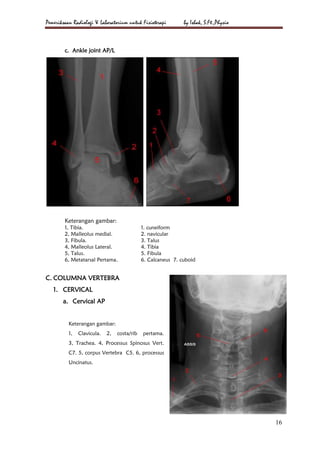 Loopografi Normal Radiologi Radiologi & laboratorium a4 | PDF