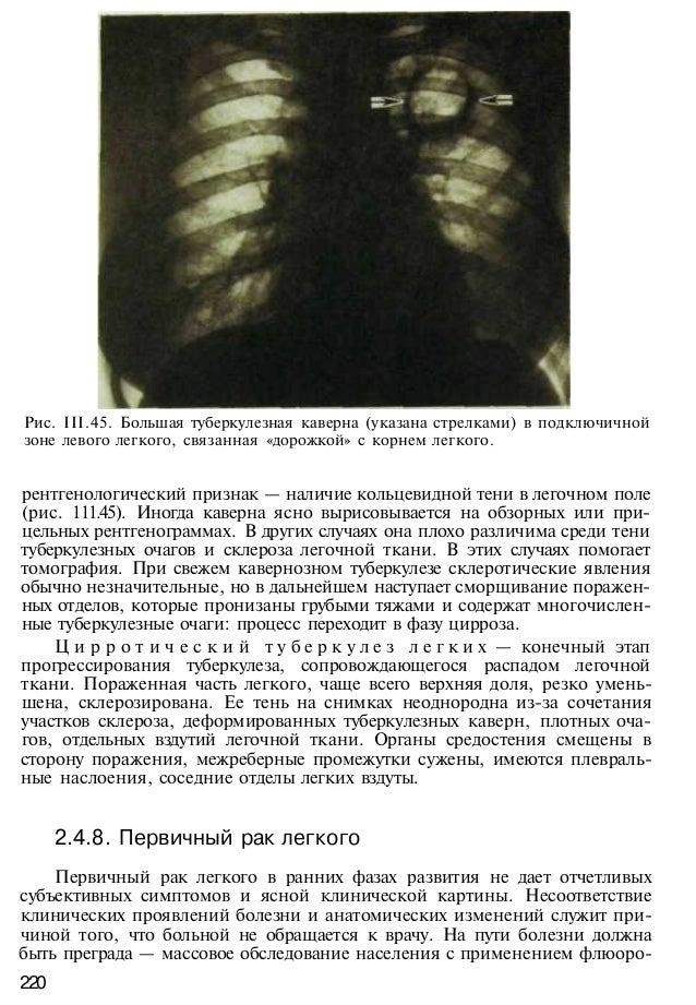 Radiologiya, учебник МЕДИЦИНСКАЯ РАДИОЛОГИЯ slideshare
