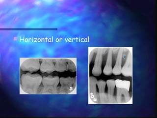 Vertical Radiograph Radiograpy in pediatric dental patient | PPT