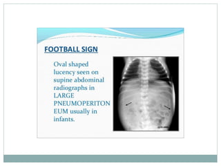Radiology signs and symptoms | PDF