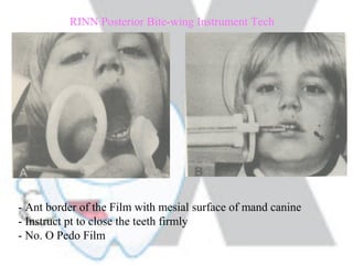 Setting Up Rinn Instruments Radiology | PPT