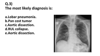radiology-2016-الحل-100.pptx