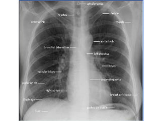 general Radiological anatomy | PPTX
