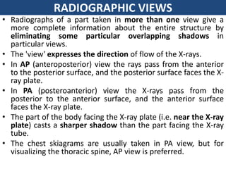 Roberts View Radiographs general Radiological anatomy | PPTX
