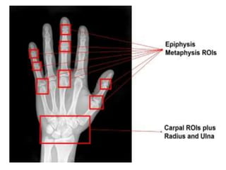 Romanulus Radiopaedia general Radiological anatomy | PPTX
