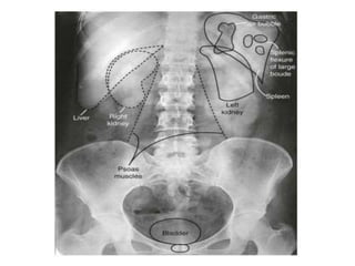 general Radiological anatomy | PPTX