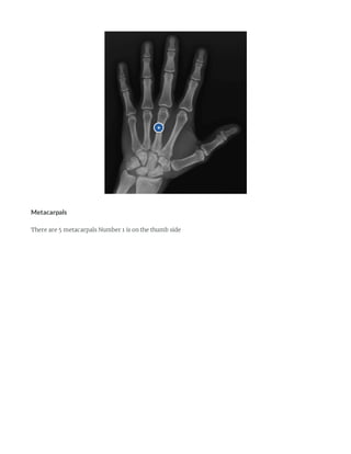 Metacarpian Rx Radiology Anatomy of the Hand and Wrist | PDF