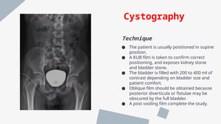 uroradiology of the genitourinary system | PPTX