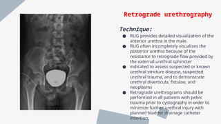 Retrogram Retrogrphy uroradiology of the genitourinary system | PPTX
