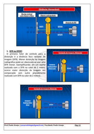 Prof. Paulo Araujo / psnsaradiologia@gmail.com / Facebook: Paulo Araujo Pág. 12
1. DFR ou DFOFI
O primeiro fator de controle para a
distorção é a distância foco receptor de
imagem (DFR). Menor distorção da imagem
radiográfica pode ser observada ao usar uma
DFR menor. Exemplificando: em um exame
realizado com a DFR no valor de 1 metro,
ocorre maior distorção da imagem em
comparação com outro procedimento
realizado com DFR no valor de 2 metros.
 