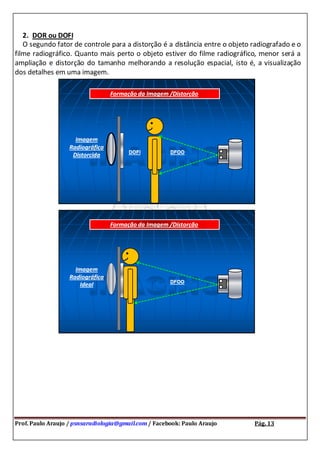 Prof. Paulo Araujo / psnsaradiologia@gmail.com / Facebook: Paulo Araujo Pág. 13
2. DOR ou DOFI
O segundo fator de controle para a distorção é a distância entre o objeto radiografado e o
filme radiográfico. Quanto mais perto o objeto estiver do filme radiográfico, menor será a
ampliação e distorção do tamanho melhorando a resolução espacial, isto é, a visualização
dos detalhes em uma imagem.
 