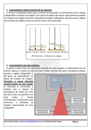 Prof. Paulo Araujo / psnsaradiologia@gmail.com / Facebook: Paulo Araujo Pág. 14
3. ALINHAMENTO OBJETO-RECEPTOR DE IMAGEM
O terceiro e importante fator para o controle da distorção é o alinhamento entre o objeto
radiografado e receptor de imagem. Se o plano do objeto não estiver rigorosamente paralelo
ao receptor de imagem ocorrerá a distorção da imagem radiográfica. Quanto maior o ângulo
de inclinação do objeto ou do raio central, maior será a distorção.
4. ALINHAMENTO DO RAIO CENTRAL
O quarto e último fator de controla da distorção em uma imagem e o alinhamento do raio
central. Apenas o centro do feixe de raios X (raio central) não possui divergência porque
projeta a região radiografada a
90 graus ou perpendicular ao
plano do receptor de imagem.
Portanto, a menor distorção
possível ocorre no raio central.
A distorção é aumentada à
medida que o ângulo de
divergência do centro do feixe
de raios X até a sua periferia. Por
esta razão, a correta
centralização é importante para
minimizar a distorção da
imagem representada em uma
radiografia.
 