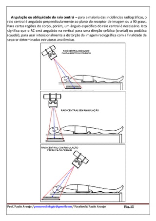 Prof. Paulo Araujo / psnsaradiologia@gmail.com / Facebook: Paulo Araujo Pág. 15
Angulação ou obliquidade do raio central – para a maioria das incidências radiográficas, o
raio central é angulado perpendicularmente ao plano do receptor de imagem ou a 90 graus.
Para certas regiões do corpo, porém, um ângulo específico do raio central é necessário. Isto
significa que o RC será angulado na vertical para uma direção cefálica (cranial) ou podálica
(caudal), para usar intencionalmente a distorção da imagem radiográfica com a finalidade de
separar determinadas estruturas anatômicas.
 