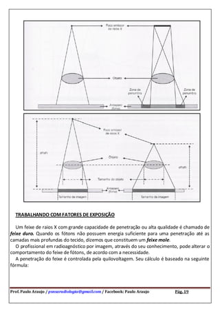 Prof. Paulo Araujo / psnsaradiologia@gmail.com / Facebook: Paulo Araujo Pág. 19
TRABALHANDO COM FATORES DE EXPOSIÇÃO
Um feixe de raios X com grande capacidade de penetração ou alta qualidade é chamado de
feixe duro. Quando os fótons não possuem energia suficiente para uma penetração até as
camadas mais profundas do tecido, dizemos que constituem um feixe mole.
O profissional em radioagnóstico por imagem, através do seu conhecimento, pode alterar o
comportamento do feixe de fótons, de acordo com a necessidade.
A penetração do feixe é controlada pela quilovoltagem. Seu cálculo é baseado na seguinte
fórmula:
 