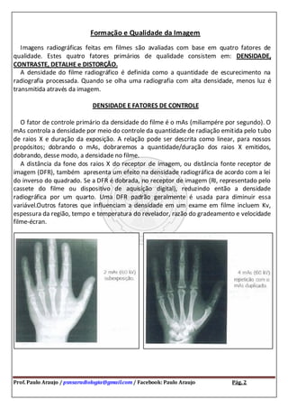 Prof. Paulo Araujo / psnsaradiologia@gmail.com / Facebook: Paulo Araujo Pág. 2
Formação e Qualidade da Imagem
Imagens radiográficas feitas em filmes são avaliadas com base em quatro fatores de
qualidade. Estes quatro fatores primários de qualidade consistem em: DENSIDADE,
CONTRASTE, DETALHE e DISTORÇÃO.
A densidade do filme radiográfico é definida como a quantidade de escurecimento na
radiografia processada. Quando se olha uma radiografia com alta densidade, menos luz é
transmitida através da imagem.
DENSIDADE E FATORES DE CONTROLE
O fator de controle primário da densidade do filme é o mAs (miliampére por segundo). O
mAs controla a densidade por meio do controle da quantidade de radiação emitida pelo tubo
de raios X e duração da exposição. A relação pode ser descrita como linear, para nossos
propósitos; dobrando o mAs, dobraremos a quantidade/duração dos raios X emitidos,
dobrando, desse modo, a densidade no filme.
A distância da fone dos raios X do receptor de imagem, ou distância fonte receptor de
imagem (DFR), também apresenta um efeito na densidade radiográfica de acordo com a lei
do inverso do quadrado. Se a DFR é dobrada, no receptor de imagem (RI, representado pelo
cassete do filme ou dispositivo de aquisição digital), reduzindo então a densidade
radiográfica por um quarto. Uma DFR padrão geralmente é usada para diminuir essa
variável.Outros fatores que influenciam a densidade em um exame em filme incluem Kv,
espessura da região, tempo e temperatura do revelador, razão do gradeamento e velocidade
filme-écran.
 