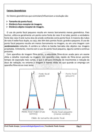 Prof. Paulo Araujo / psnsaradiologia@gmail.com / Facebook: Paulo Araujo Pág. 9
Fatores Geométricos
Os fatores geométricos que controlam/influenciam a resolução são:
 Tamanho do ponto focal;
 Distância foco-receptor de imagem;
 Distância objeto-receptor de imagem.
O uso do ponto focal pequeno resulta em menos borramento menos geométrico. Para
ilustrar, utiliza-se geralmente um ponto como fonte de raios X no tubo; porém a verdadeira
fonte dos raios X está numa área do anodo conhecida como ponto focal. A maioria dos tubos
de raios X exibe foco duplo, ou seja, eles têm dois pontos focais: grande e pequeno. O uso do
ponto focal pequeno resulta em menos borramento na imagem, ou em uma imagem com
sombreamento reduzido. A sombra se refere às bordas borradas dos objetos nas imagens
projetadas. Entretanto, mesmo com o uso de ponto focal pequeno, alguma sombra continua
presente.
Com aparelhos de imagem filme-écran, a velocidade filme-écran usada para um exame
afeta o detalhe mostrado na imagem. Um aparelho mais rápido de filme-écran permite
tempos de exposição mais curtos, o que é útil para limitação de movimentos e redução da
dose de radiação; no entanto a imagem é menos nítida do que quando se emprega um
aparelho filme-écran mais lento.
 