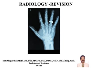 RADIOLOGY -REVISION
Dr.N.Mugunthan,MBBS.,MS.,DNB.,MNAMS.,PhD.,FAIMS.,MRSM.,MBA(Hosp.Adm.)
Professor of Anatomy
SMIMS
 